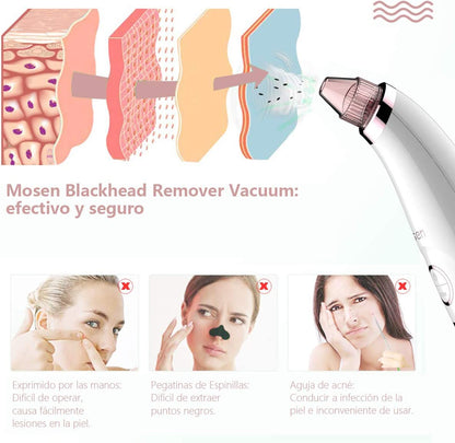 #proSuccionador de Puntos Negros | Limpiador Facial | Remover Puntos Negros | USB Recargable con Pantalla LEDduct_name# - TeknoTienda
